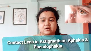 Contact Lens in Astigmatism Aphakia amp Pseudophakia [upl. by Kreitman671]