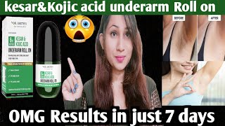 Dr Sheth Kesar amp Kojic acid underarm Roll on honest ReviewKesar ampKojic acid underarm Roll on [upl. by Inneg976]