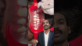 🔍செராமிக்🦷 கிளிப்  ceramic braces orthodontic ceramicbraces dranbudentist [upl. by Ardith]