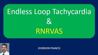 Endless Loop Tachycardia and RNRVAS [upl. by Annasoh]