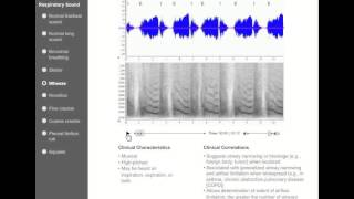 Chest Auscultation  Clinical Examination [upl. by Shaun]