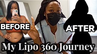 SURGERY VLOG I GOT AWAKE LIPO 360😳 Experiencing Complications  BEFORE amp AFTER [upl. by Ohce]