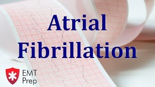 Atrial Fibrillation ECG  EMTprepcom [upl. by Laris]