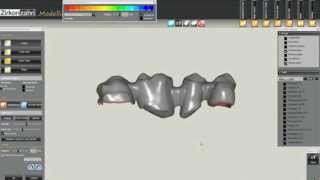 Prótese fixa  4 elementos  Sistema CAD CAM  In Lab  Software  Zirkonzahn  Talladium do Brasil [upl. by Schubert]