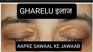 AANKHON PAR PEELE CHAKTE XANTHELASMA  AAPKE SAWAAL MERE JAWAAB [upl. by Einwahr]