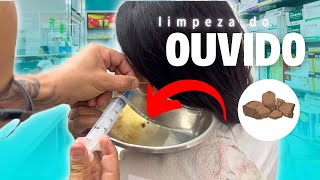 LIMPEZA DO OUVIDO UMA CERA GIGANTE Completa [upl. by Post]