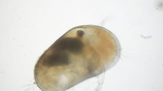 Ostracoda [upl. by Aicire]