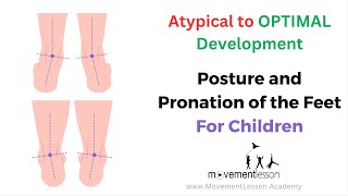 Atypical Development Baby Posture and Pronation of the Feet [upl. by Ahsenrat938]