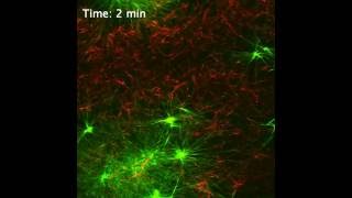 Realtime imaging of supramolecular nanofibers [upl. by Crosse]