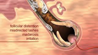 Learn how Demodex mites cause blepharitis [upl. by Renata383]