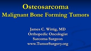 Orthopedic Oncology Course  Malignant Bone Forming Tumors Osteosarcoma  Lecture 4 [upl. by Tal]