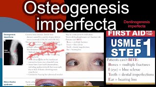 Osteogenesis imperfecta  Dentinogenesis imperfecta in HindiUrdu by first aid for USMLE step 1 [upl. by Acessej]