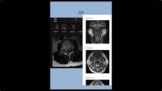 RADIOLOGY EXAM CASES [upl. by Tterrab]