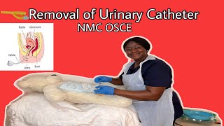 Removal of Urinary Catheter [upl. by Arther]