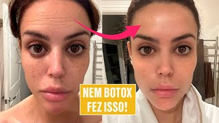 Rejuvenesci minha pele com produto de farmácia [upl. by Savina]