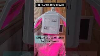 Hair regrowth treatment GFCHAIR hair haircare hairtransformation gfctherapy gfc laser [upl. by Clementas]