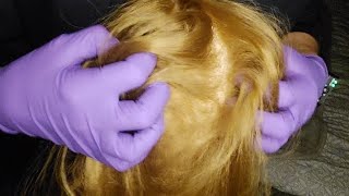 ASMR FAST amp AGGRESSIVE SCALP SCRATCHING aggressiveasmr aggressivescratching asmrsounds [upl. by Hanahsuar]