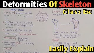 Deformities Of Skeleton  Arthritis  Osteoporosis  Herniation  Class 12 [upl. by Ayotnahs]