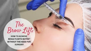 The Brow Lift How to Achieve Results with BOTOX® without the need for Surgery [upl. by Nerland]