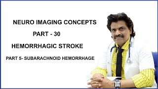 NEUROIMAGING CONCEPTS PART  30HEMORRHAGIC STROKEPART 5 SUBARACHNOID HEMORRHAGE [upl. by Erle323]