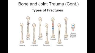 Chapter 51 Alterations in Musculoskeletal Function Trauma Infection Disease [upl. by Arual]