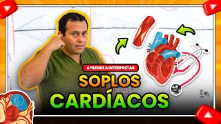 SOPLOS CARDIACOS APRENDE A INTERPRETARLOS ✍🩺 🔊  Semiología Cardiaca [upl. by Ludvig]