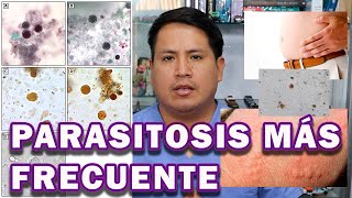 Blastocystis hominis PIDEMIOLOGÍA DIAGNÓSTICO Y TRATAMIENTO [upl. by Ainedrag550]