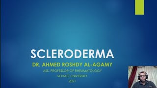 4 Systemic Sclerosis Scleroderma [upl. by Masha]