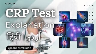 CRP Test Guidelines Your Guide to Inflammation and Health [upl. by Rentschler]