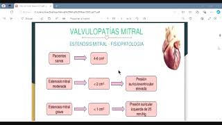 Cardiopatía valvular mitral y tricuspidea  AngioCardiología  sem 7 [upl. by Aneri]