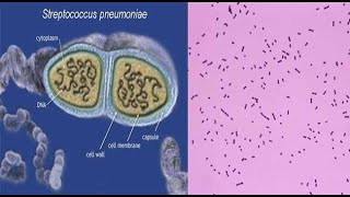 Streptococcus pneumoniae [upl. by Bonnibelle]