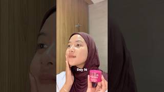 RETINOL ATAU MERKURI‼️ [upl. by Crescint]