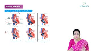 Heart Failure Hindi  Internal Medicine [upl. by Daveen]