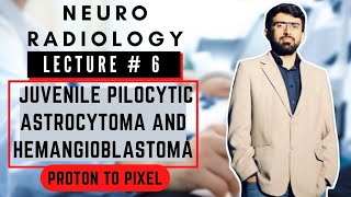 Difference between Juvenile Pilocytic Astrocytoma and Hemangioblastoma l Neuro Radiology l [upl. by Ballman]