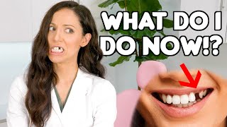 How To REPLACE A Missing Tooth Best Tooth Replacement Options [upl. by Eleanora]