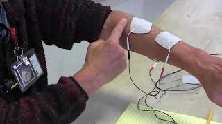 Stroke Rehabilitation Use of electrical stimulation to help arm and hand recovery [upl. by Gaelan]