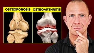 How to Prevent and Treat Osteoporosis vs Osteoarthritis full guide [upl. by Netsrejk]