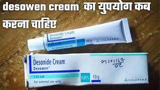 Desowen cream uses in hindi Desonide cream 005 ww  Desonide cream  Desowen cream price [upl. by Codee167]