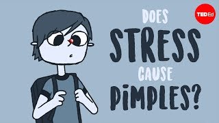 Does stress cause pimples  Claudia Aguirre [upl. by Oznol59]