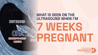 Week 7 Pregnant Ultrasound Babys Heartbeat amp Growth Shown [upl. by Dumah]