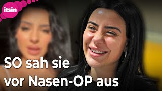 DschungelcampStar Leyla Lahouar So sah sie vor ihrer NasenOP aus • its in [upl. by Pompea]