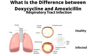 What Is the Difference between Doxycycline and Amoxicillin [upl. by Iliam]