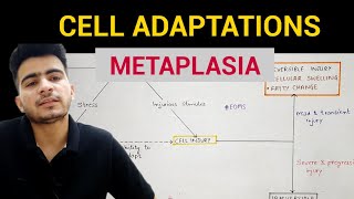 Metaplasia  Cell Adaptations 33  General Pathology  EOMS [upl. by Balkin]