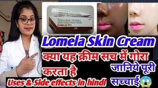 Lomela Skin Cream  Lomela Cream honest review  Lomela Cream benefits uses amp side effects in hindi [upl. by Razal434]