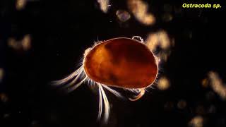 Ostracoda sp  Protozoans and other small critters [upl. by Suzetta]