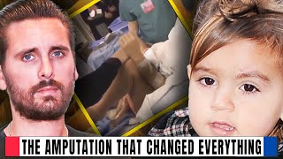 Scott Disick and Mason Discuss Life After Amputation [upl. by Aissenav117]