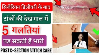 Post CSection Stitch CareHindiDr Shruti [upl. by Latreece]