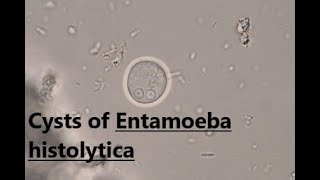 Cysts of Entamoeba histolytica  Saline wet mount  labmedicine9265 [upl. by Ackley176]