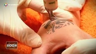 Cómo borrar tatuajes con láser [upl. by Llezo]