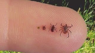 Doctor explains what you should know about ticks [upl. by Clothilde]